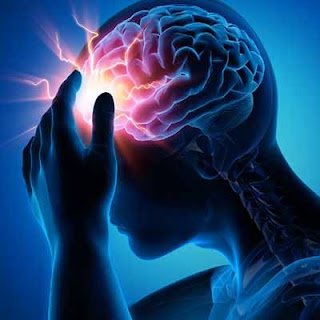 Clinical EEG Monitoring and Epilepsy Management A neurological medical specialist explaining brain wave activity on an EEG monitor to a patient