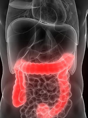 Colorectal Cancer: Symptoms and Prevention Tips Everyone Should Know Digestive system health concept