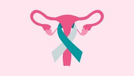 Ovarian Cancer Awareness – Female Ovary Anatomy Illustration Detailed illustration of female ovaries and reproductive organs highlighting ovarian cancer awareness, symptoms, and women's health.