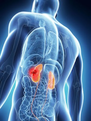 Early Signs and Symptoms of Kidney Cancer Infographic showing early warning signs and symptoms of kidney cancer including blood in urine and back pain.
