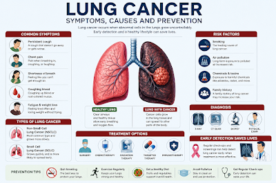 Lung Cancer: Symptoms, Causes, and Prevention Medical illustration showing lung cancer awareness, symptoms, and healthy lungs concept.